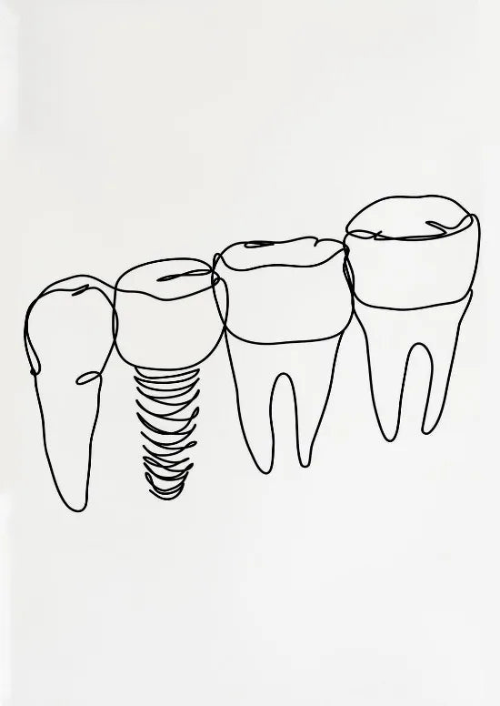 Dental Appliances for Dental Health Minimalist Teeth Dentistry Decor Canvas Painting Wall Picture Dental Hospital Wall Art Decor